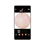 楽天市場】KEANA SUCTION MITESU ケアナサクション ミテス (グレー