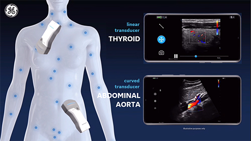 Vscan Air CL（超音波 ポータブル） - GEヘルスケア・ジャパン株式会社