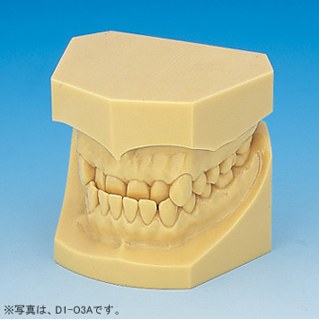 1色レジン製不正咬合顎模型 [D1D-O各種](D咬合器つき)｜株式会社