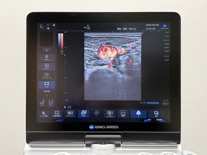 超音波診断装置｜コニカミノルタ｜SONIMAGE HS2｜中古医療機器の販売