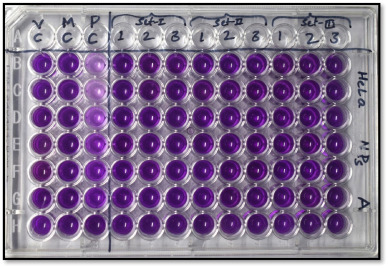 Biointeractions of Mn-doped citrate-coated magnetite nanoparticles
