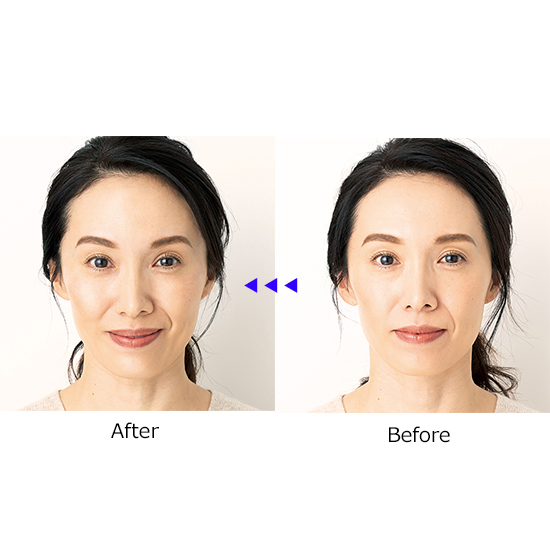 hy】【未使用】ヤーマン メディリフトアイ 取説付き メディリフト アイ