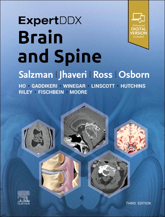 Expert Differential Diagnoses: Brain & Spine, 3rd ed.: 洋書／南江堂