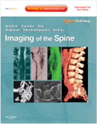 Imaging of the Spine (Expert Radiology Series): 洋書／南江堂