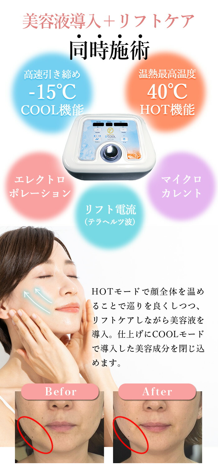 FORTUNA D-COOL - セルフエステ フェイシャルケア 業務用美容機器の