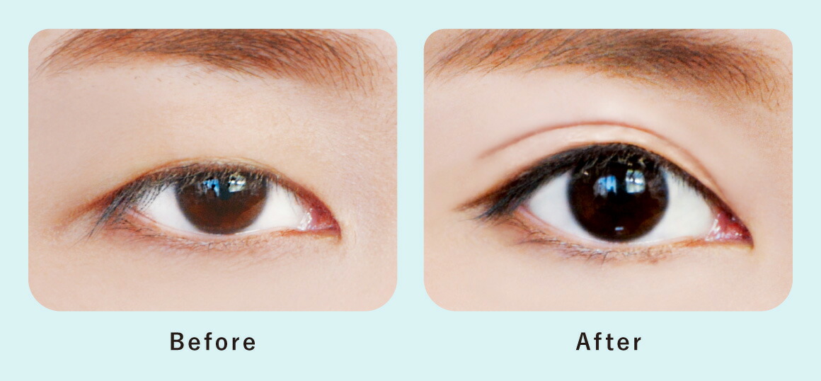 楽天市場】【公式ストア】 湘南美容 アイリッドフィルム 二重 アイプチ