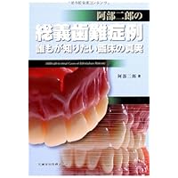 下顎総義歯吸着テクニック ザ・プロフェッショナル | 阿部 二郎, 岩城