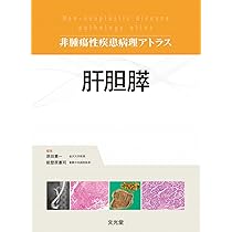 リンパ組織 (非腫瘍性疾患病理アトラス) | 佐藤康晴, 竹内賢吾 |本
