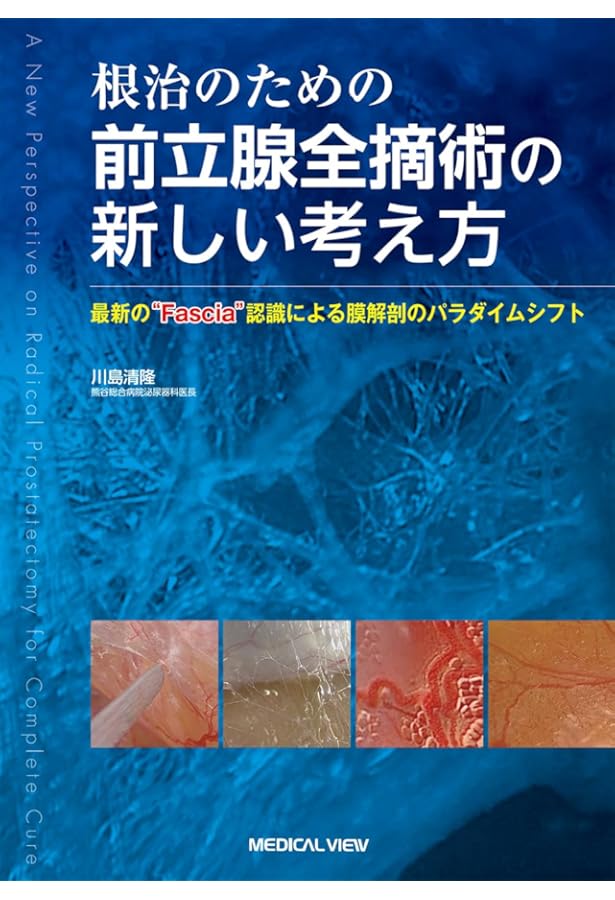 究める鏡視下膀胱全摘術・尿路変向術 Level up LRC, RARC | 三木 淳