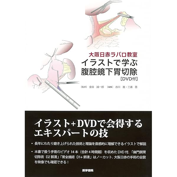 Amazon.co.jp: 癌研スタイル 腹腔鏡下胃切除術 : 山口 俊晴, 福永 哲