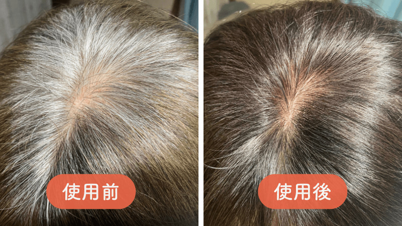 口コミ悪い？】ビーリスエアリーカラーリングフォームの白髪染めは