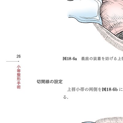 イラストでみる口腔外科手術 第3巻