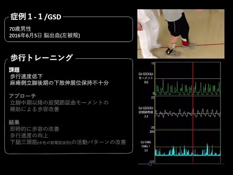 T-Support使用による脳卒中片麻痺患者へのアプローチ③ | パシフィック