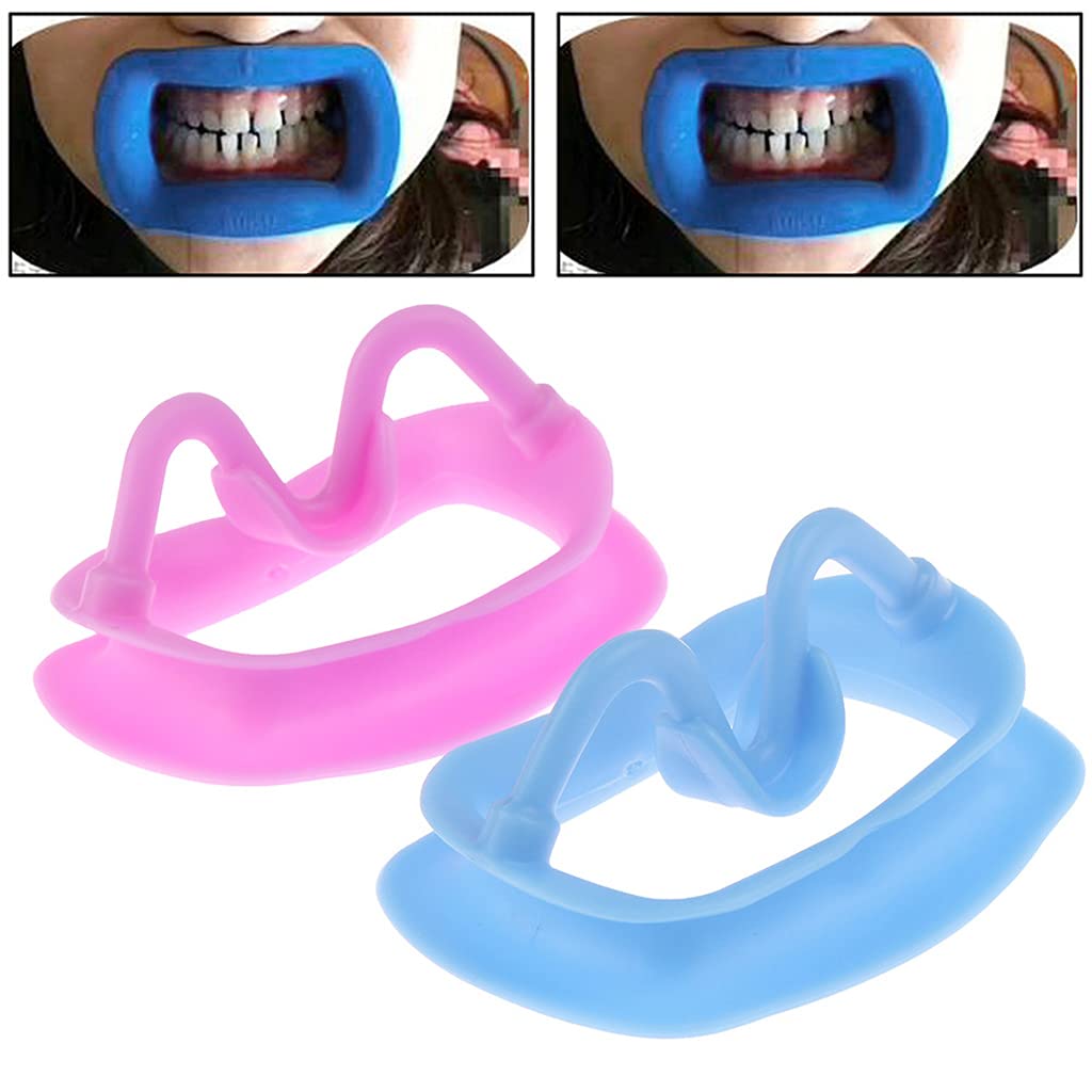 Amazon.co.jp: プロフェッショナル歯科リップ頬リトラクターマウス