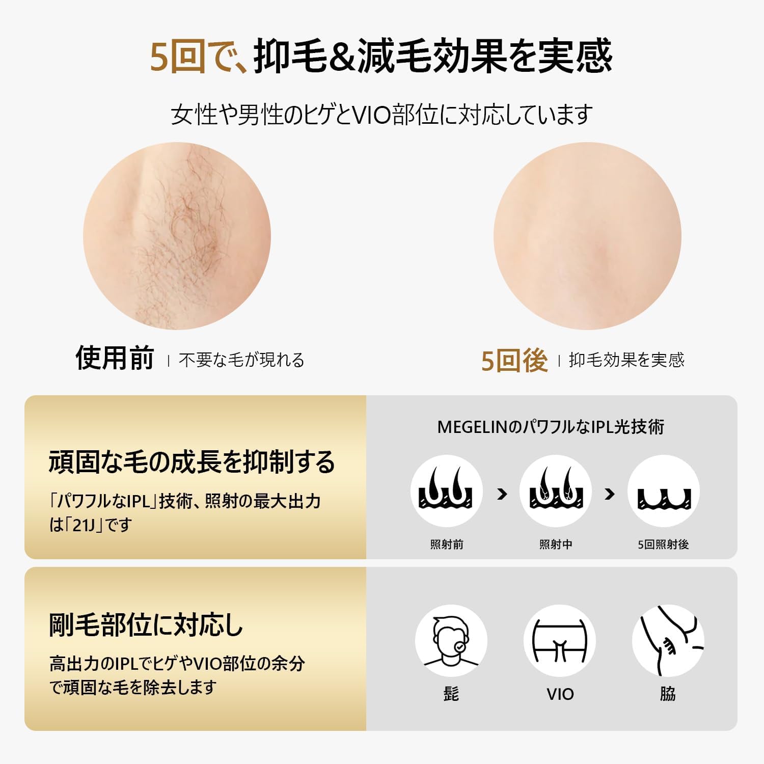 MEGELIN Lightサファイア脱毛器 JRB ホワイト 脱毛 家庭用 MEGELIN