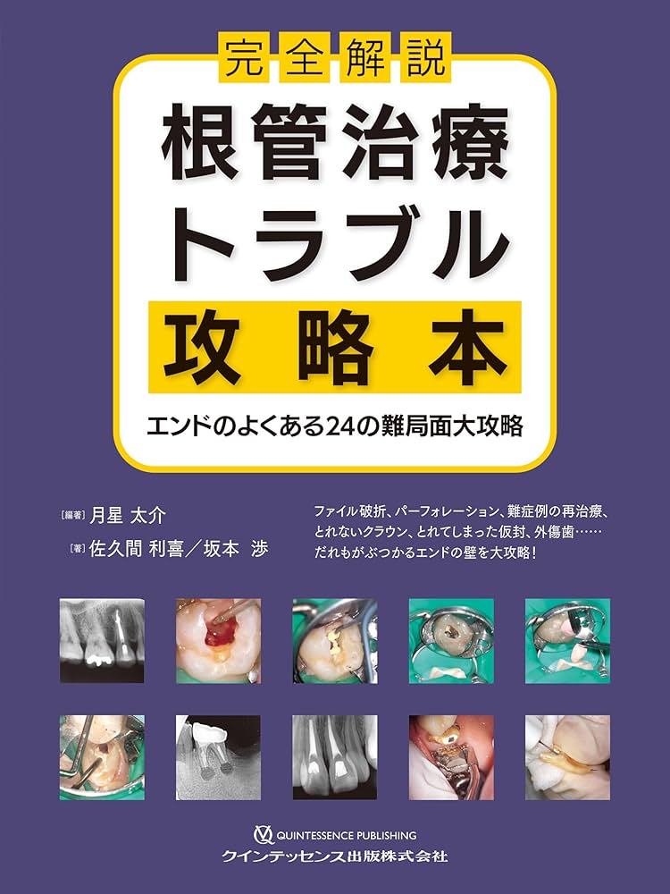 完全解説 根管治療トラブル攻略本: エンドのよくある24の難局面大攻略