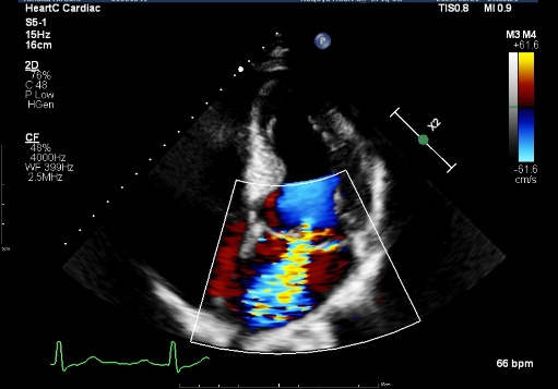 名古屋ハートセンター＜循環器医療のスペシャリストとして＞ | 超音波検査