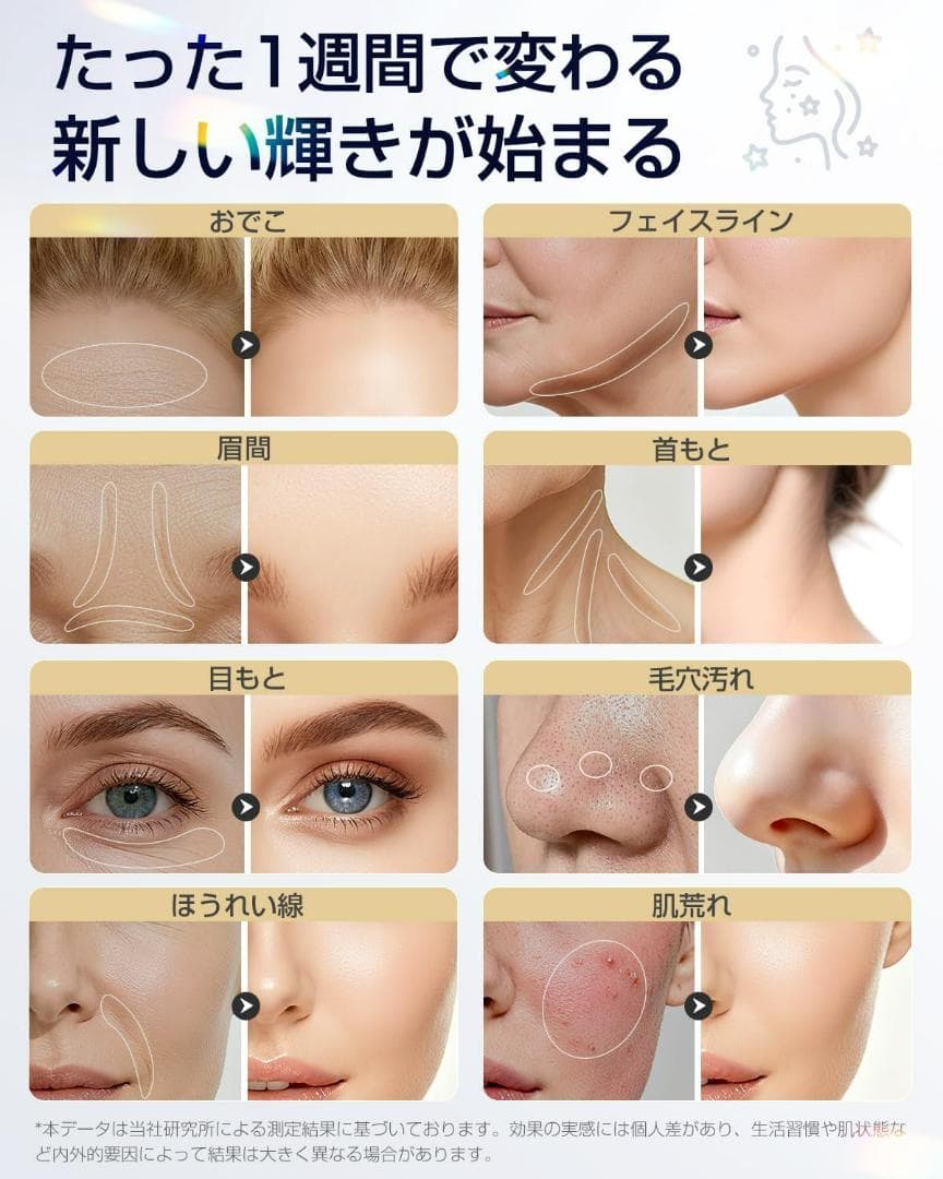 美顔器 高周波 RF EMS MC・リフトケア・フェースラインケア・毛穴洗浄