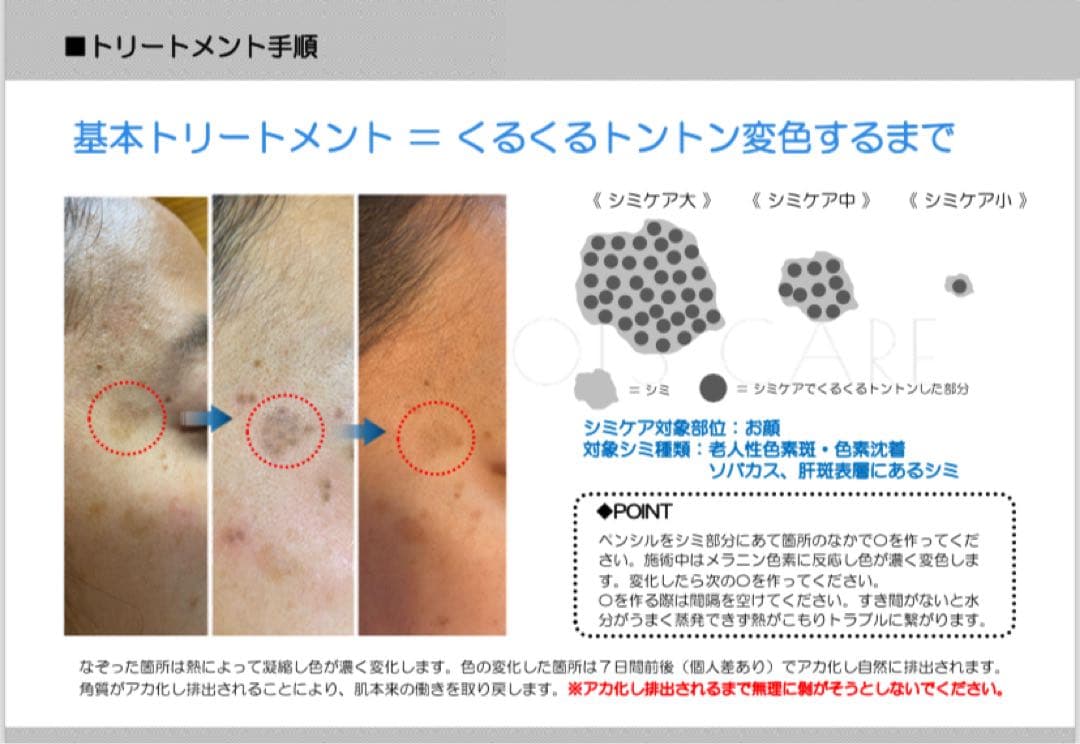 新品★送料無料★シミケア機器★タッチパネル式★簡単♪業務用・ホームケア使用可能★