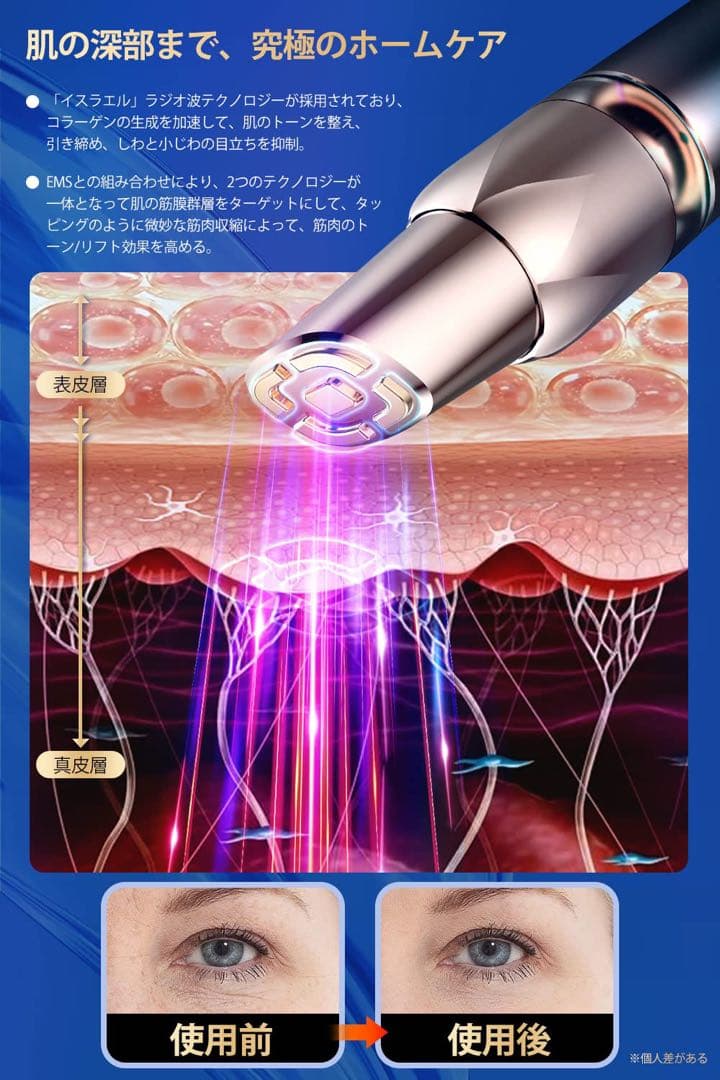 目元美顔器 3in1目元ケア RF美顔器 引き締め 美顔器EMS 浸透率アップ
