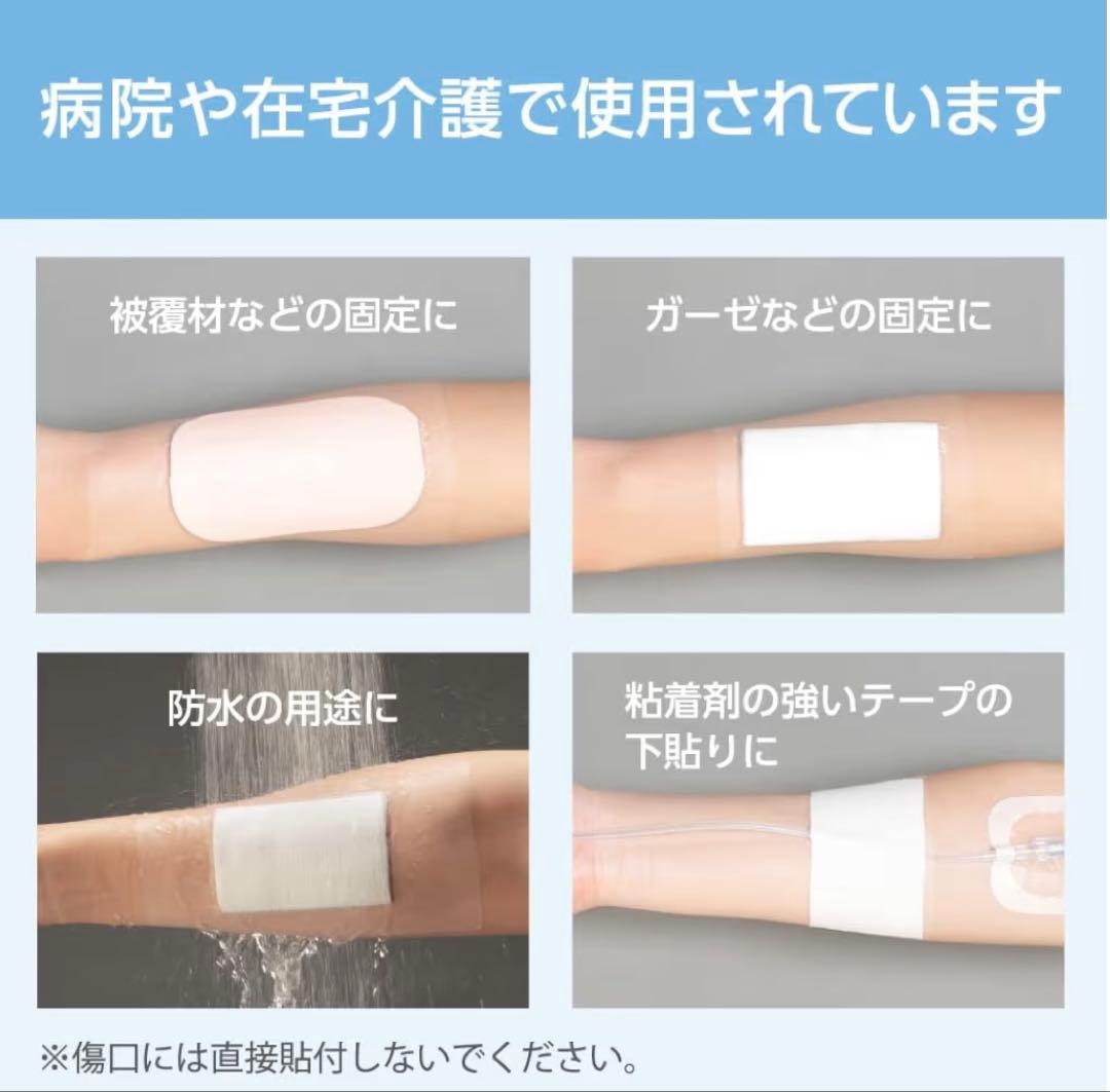 Nitto パーミロール Lite L34R15 15cm x 12m - メルカリ