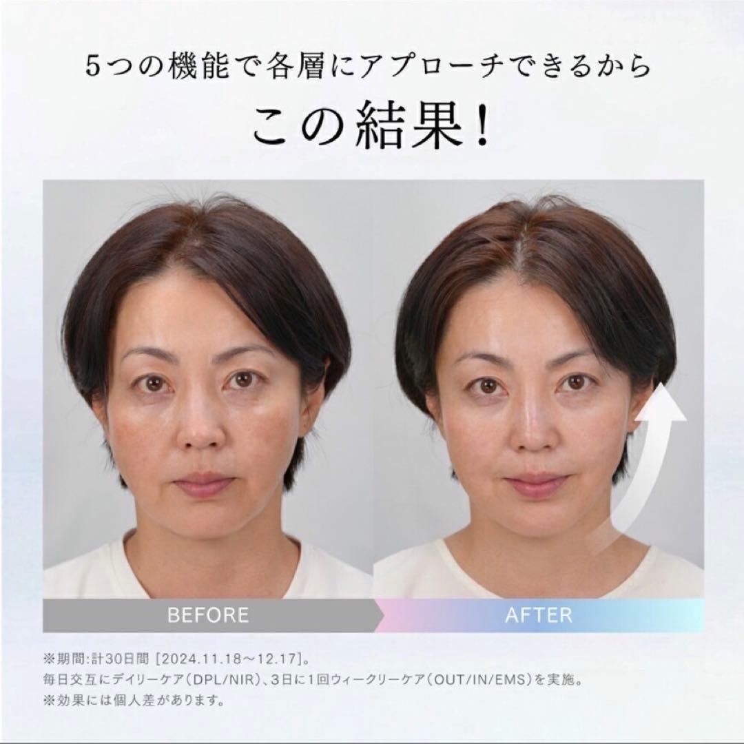 【新品未開封】 MYTREX MiRAY ONE ホワイト　ミライワン　美顔器