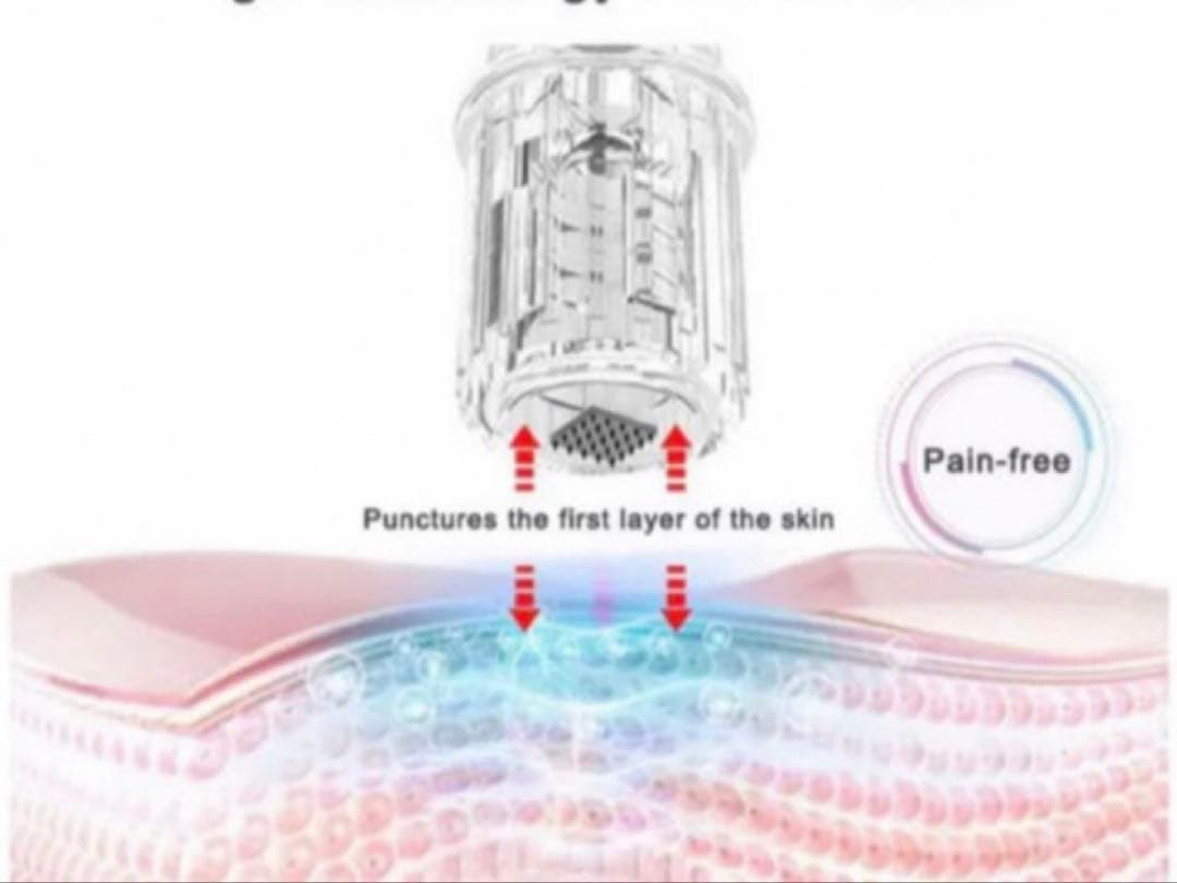 ありん！【新品】リゼネレート対応　同型マイクロニードルペンチップ10個付き