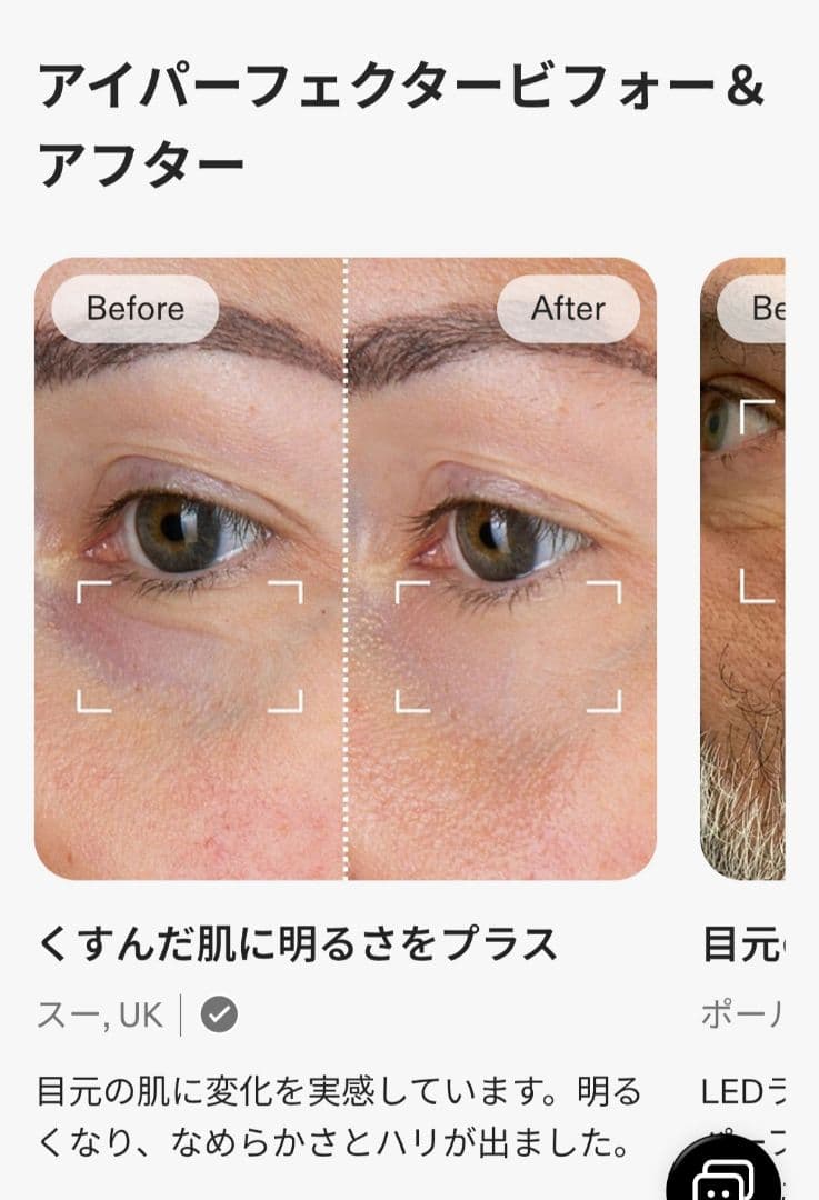 ボディ・フェイスケア CURRENTBODY LED EYE PERFECTOR
