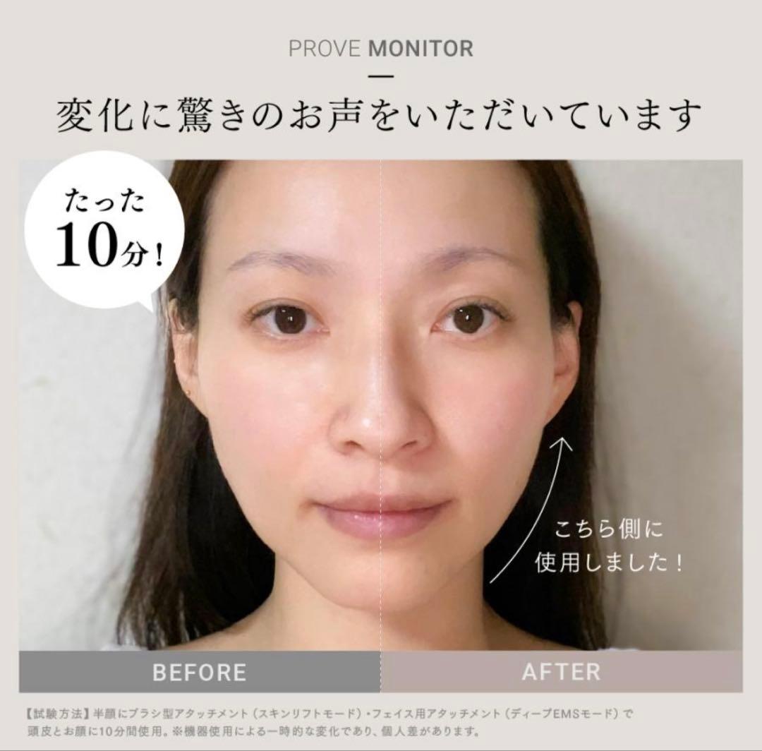 MYTREX トータルリフト美顔器 EMS PROVE