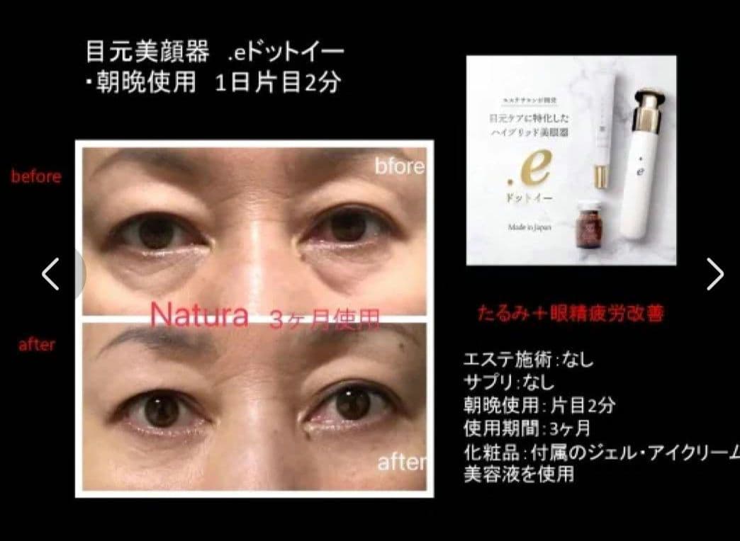 格美品 .e ドットイー　ナトゥーラ　Natura 目元専用美眼器